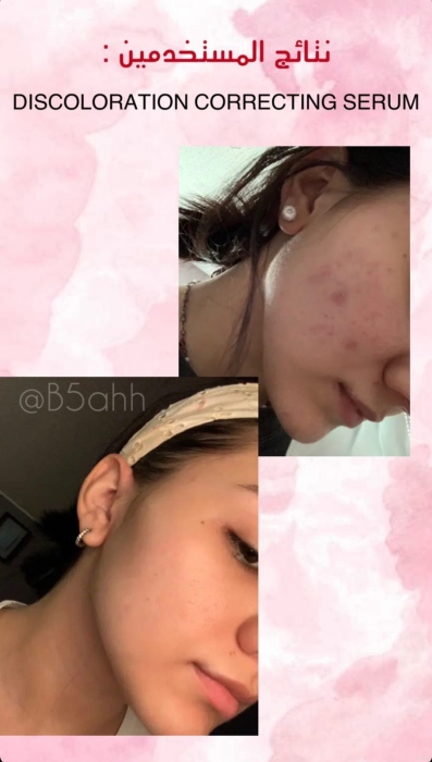 Good molecules, Discoloration Correcting Serum
